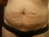 stomach.jpg