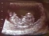 Baby 1 29 juni 2012.jpg