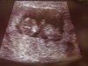 Baby 2 29 juni 2012.jpg