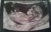 baby 5.jpg