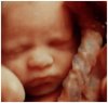 baby-echo-slide2.jpg