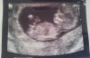 baby 2014.jpg