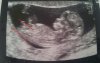 baby 5.jpg