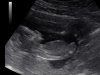 201310012021110019ABDnub.jpg