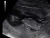 201310012027490025ABDnub.jpg