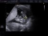 ECHOWONDER_0009.jpg