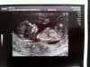 echo 2013.10.30 12 weken 6 cm (640x477).jpg