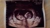 20131028_165157.jpg