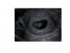 echo 8wk.jpg