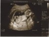 Scan 2.jpg