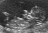 13-10-22-150134_vd elsen_20131022_150134_20131022_151410_0023-1.jpg