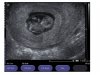 echo10wk.jpg