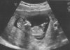echo 2 12 wk.jpg