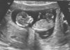 echo 1 12 wk.jpg