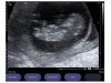 echo11wk.jpg
