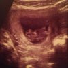 baby1.jpg