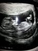 baby12w5d.jpg