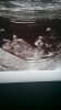 baby 11wk.jpg