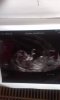 baby NUB.jpg