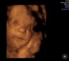 BABY WIELSTRA_250.jpg