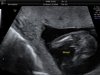 Baby Kannekens 16 wkn_6.jpg
