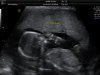 Baby Kannekens 16 wkn_11.jpg