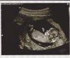 echo 12wk4 001.jpg