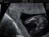 Baby Kannekens 16 wkn_14.jpg