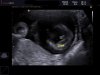 BABY_0003.jpg