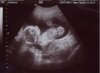 17wk.jpg