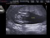 BABY CORNELISSE_0007.jpg