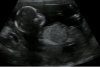 Baby1.jpg