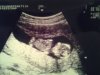 baby1.jpg