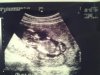 baby2.jpg