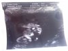 baby.jpg