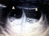 echo 7 week.jpg
