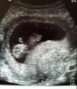 baby3.jpg
