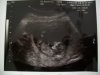 echo 11 wk 5 dgn beentje omhoog.jpg