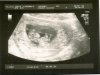 scan 10w 4d0002.jpg