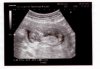 Brusje_ echo_4-7-12.jpg