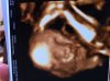 Baby 3D 1.jpg