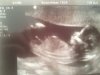 echo14wk.jpg