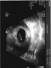 1e  echo meting 001.jpg
