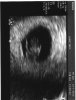 1e echo foto 001.jpg