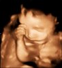 baby oost-1-2.jpg