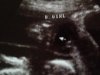 Baby B meisje.jpg