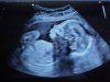 echo20wk.jpg
