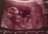 echo 12 wk.jpg