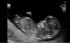 echo 12 wk.jpg