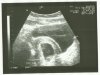 Eerste echofoto baby 8-8-2013.jpg